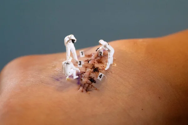 Stitches Cirurgia Sendo Manipulados Por Figuras Escala Miniatura Imagens De Bancos De Imagens