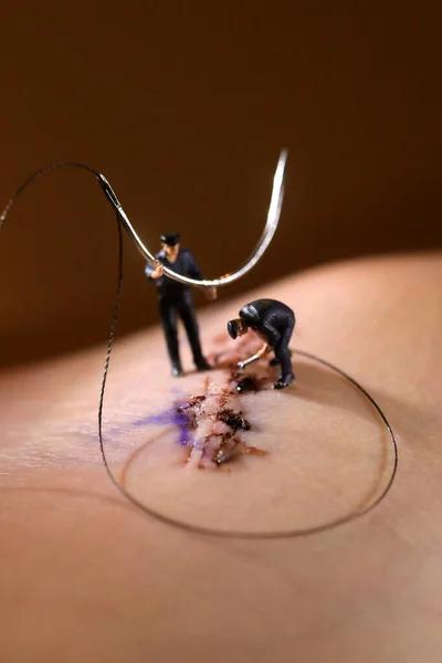 Stitches Cirurgia Sendo Manipulados Por Figuras Escala Miniatura Imagens De Bancos De Imagens