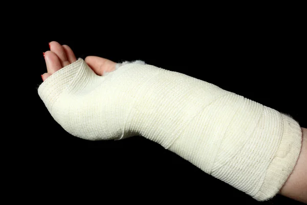 Orthopädischer Gips — Stockfoto