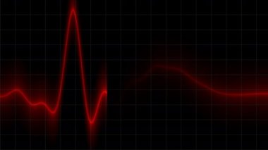 Heartbeat Heart Beat Heartrate Monitor Animation