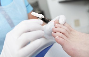 Pedikür ile romatizma ayak tedavi