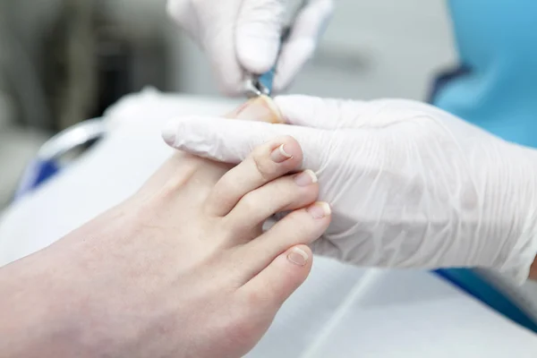 Cutting toe nails bij pedicure — Stock Photo, Image