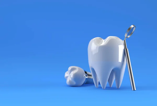 Concetto Chirurgia Degli Impianti Dentali Rendering — Foto Stock