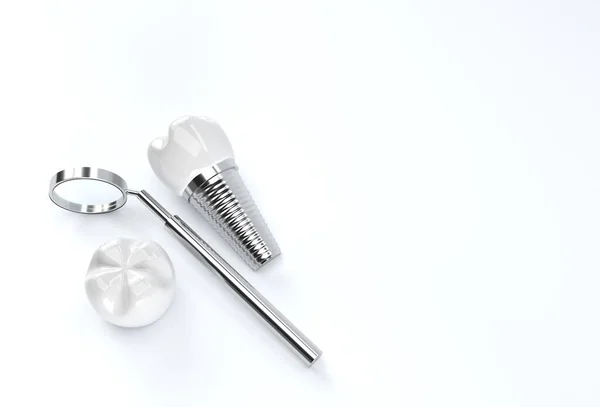 Concepto Cirugía Implantes Dentales Rendering — Foto de Stock