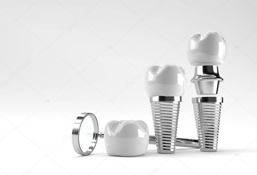 Dental Implants surgery concept 3D Rendering.