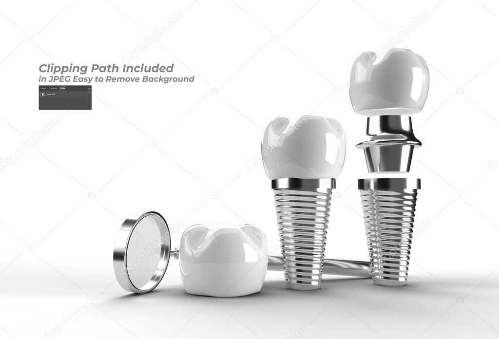 Dental Implants surgery concept Pen Tool Created Clipping Path Included in JPEG Easy to Composite.