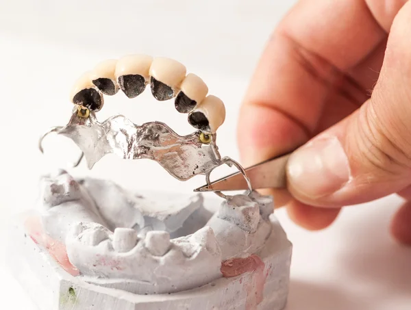 Metal Ceramic Bridge — Stock Photo, Image