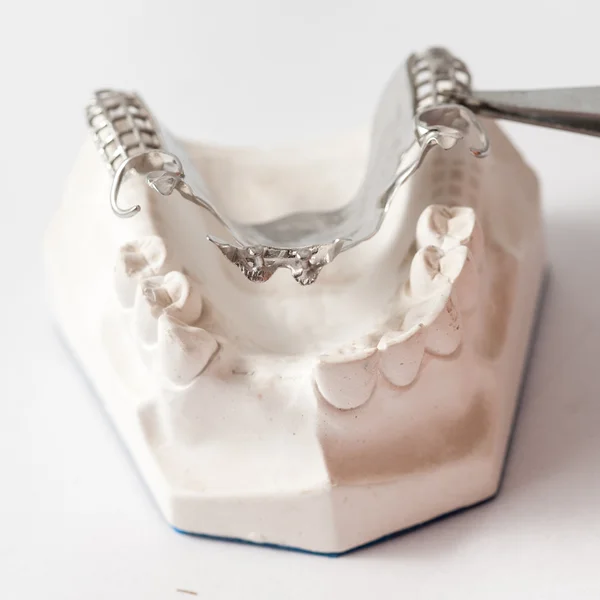 Dentadura parcial inferior com acessórios — Fotografia de Stock
