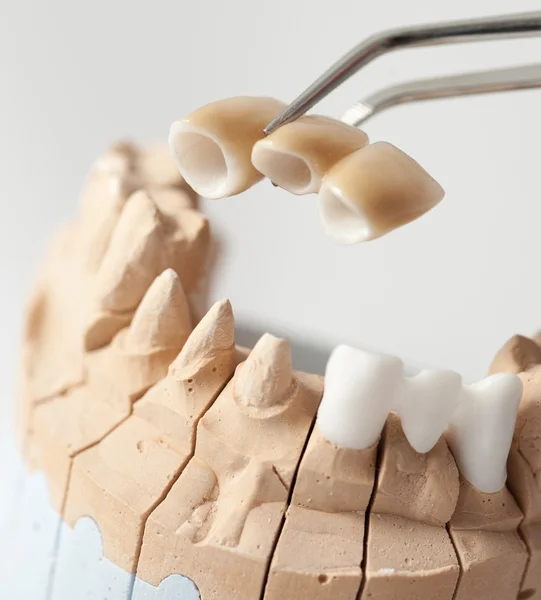 Dental prothetic laboratory — Stock Photo, Image