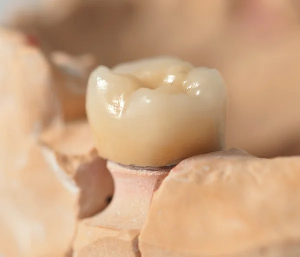 Οδοντοτεχνικό εργαστήριο prothetic — Φωτογραφία Αρχείου