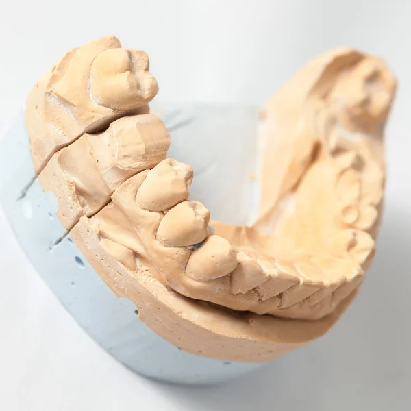 치과 prothetic 실험실 — 스톡 사진