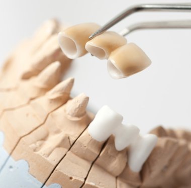 Dental prothetic laboratory clipart