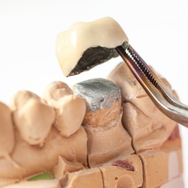 Dental prothetic laboratory clipart