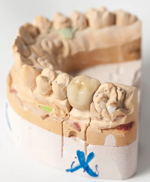 Dental prothetic laboratory — Zdjęcie stockowe