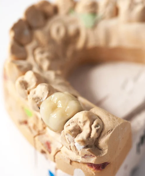 Лаборатория зубного протеза — стоковое фото