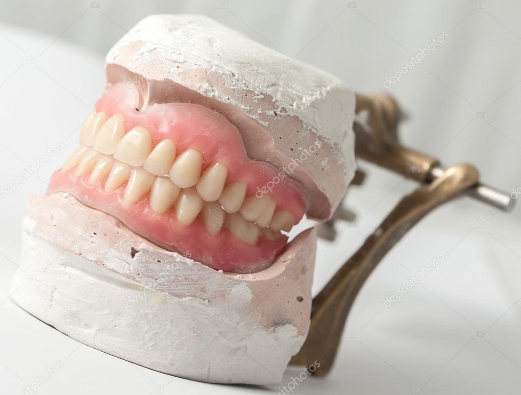 Dental plate detailed