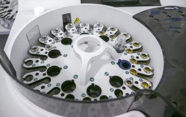 Santrifüj kan ve idrar testi