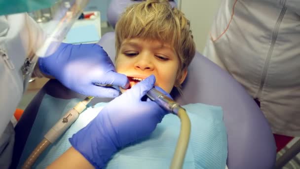 Medical dentist procedure of teeth treatment — Stock Video