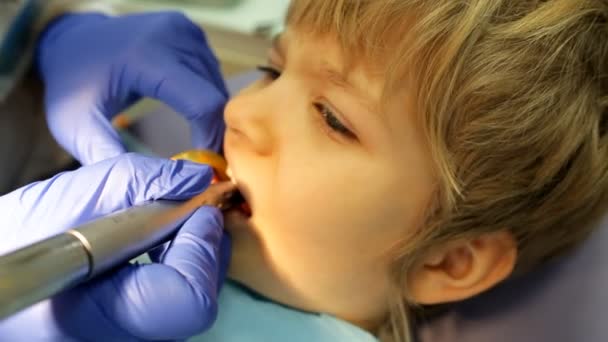 Niño con la boca abierta durante el tratamiento de perforación en el dentista — Vídeos de Stock