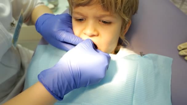 Closeup little kid at dentist clinic office. — Stock Video