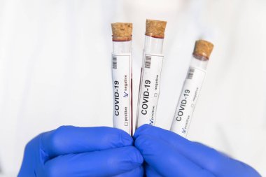 Pozitif ve negatif kovid 19 testi olan bir doktor.