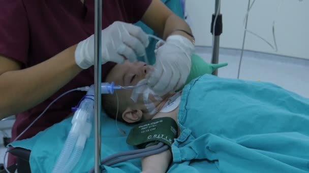 Operação de cirurgia infantil — Vídeo de Stock