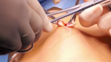 Hastanede cerrahi operasyon