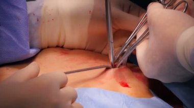 Hastanede cerrahi operasyon