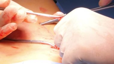 Hastanede cerrahi operasyon