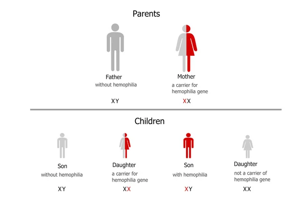 Hemofilia dziedziczenia — Wektor stockowy