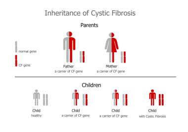 Cystic Fibrosis (mucoviscidosis) inheritance clipart
