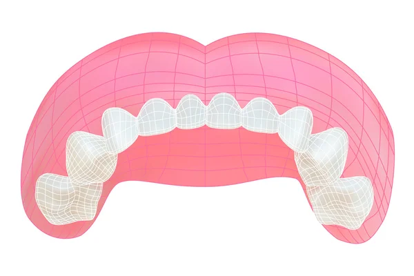 Teeth of the upper jaw. Vector illustration with visible mesh. — Stock Vector