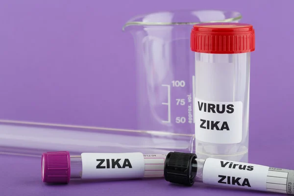 Foto concepto virus Zika con tubo de ensayo — Foto de Stock