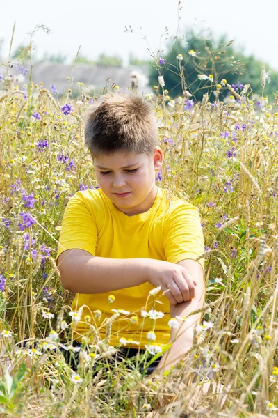 Boy with an allergy to  hands — Stockfoto