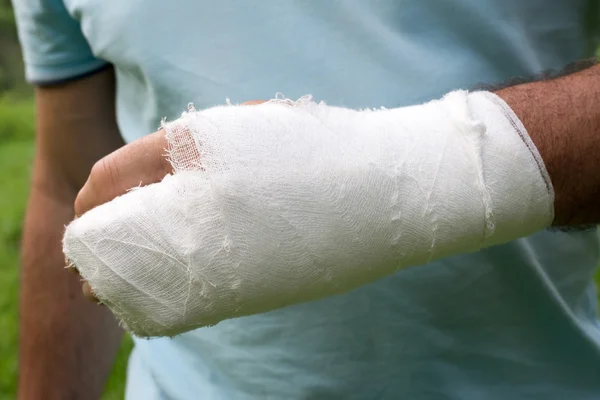 Άνδρες με σπασμένο το δεξί του χέρι — Φωτογραφία Αρχείου