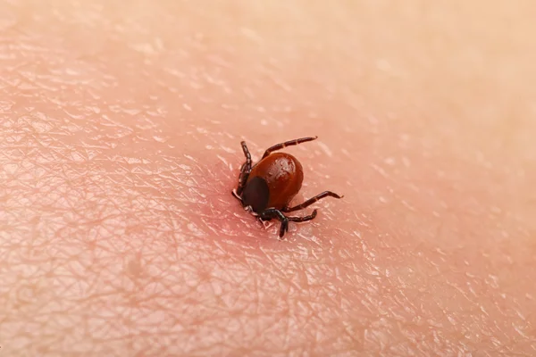 Encephalitis tick — Stock Photo, Image