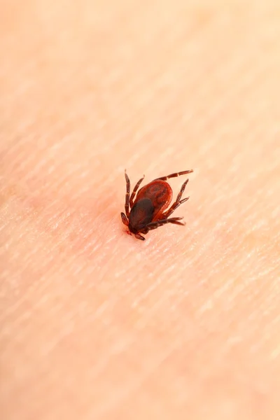 Encephalitis tick — Stock Photo, Image