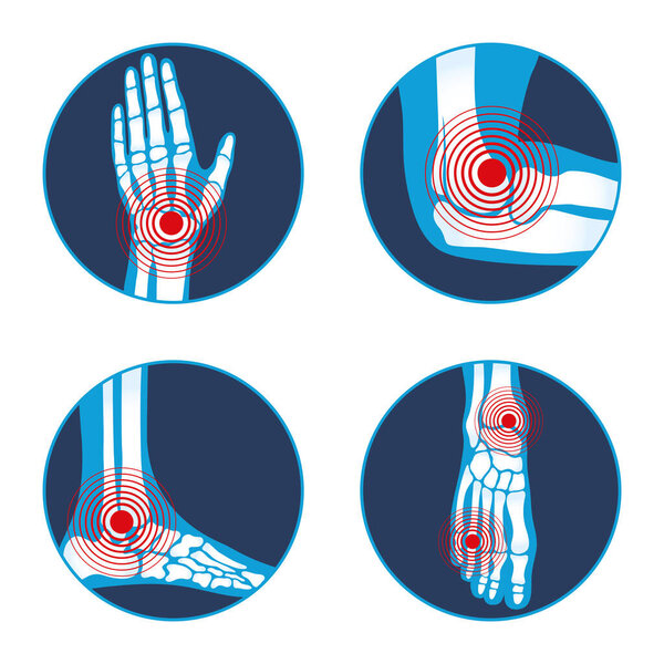 four rheumatology icons