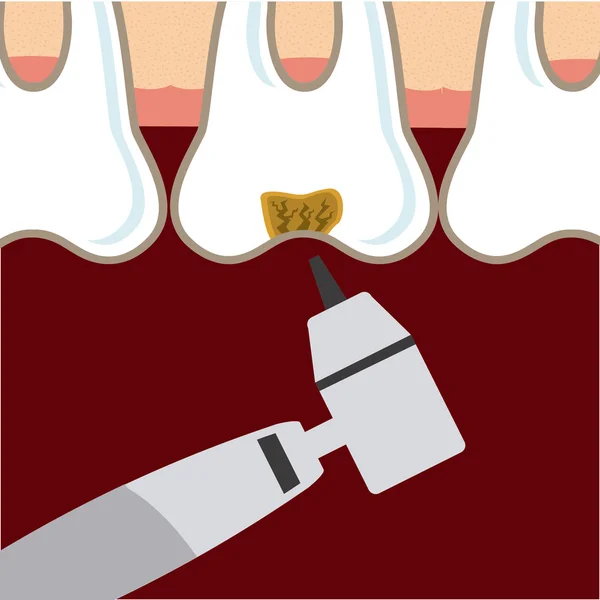 Tandheelkundige verzorging — Stockvector