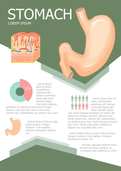 Infográfico do estômago humano — Vetor de Stock