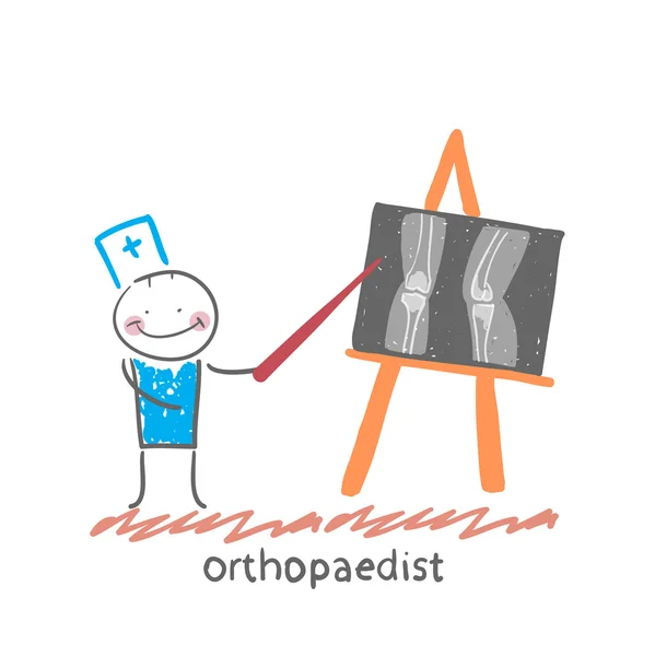 Ortopedista muestra una radiografía — Vector de stock