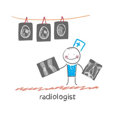 radyolog x-ray görüntüleri ile