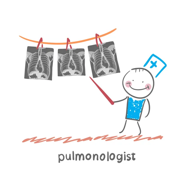 Pulmonólogo muestra una radiografía — Vector de stock