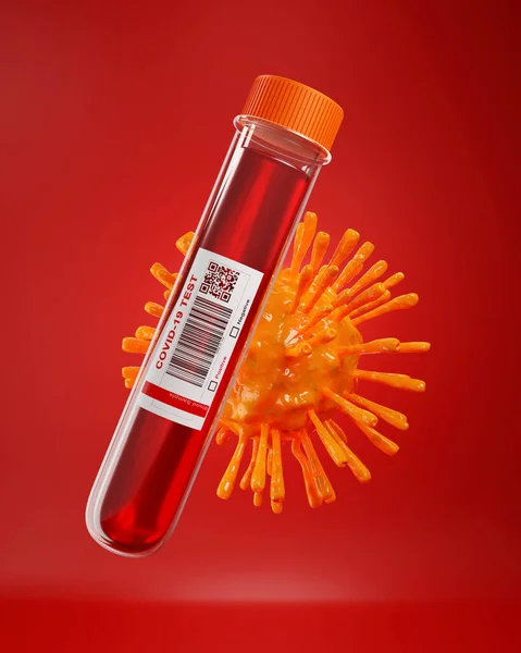 COVID-19 Esame del sangue che mostra il virus — Foto Stock