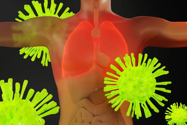 Coronavirus valt het menselijk lichaam aan — Stockfoto