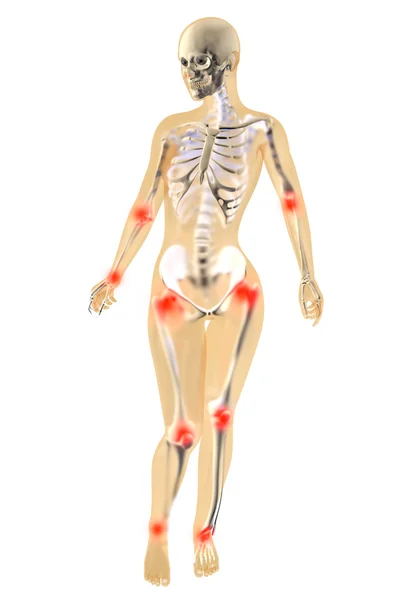 Weibliche Anatomie - Gelenkschmerzen — Stockfoto