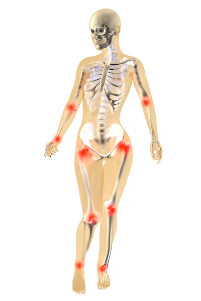 स्त्री ऍनाटॉमी संयुक्त वेदना — स्टॉक फोटो, इमेज