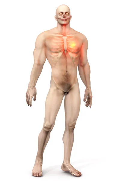 Ataque cardíaco en un cuerpo masculino —  Fotos de Stock