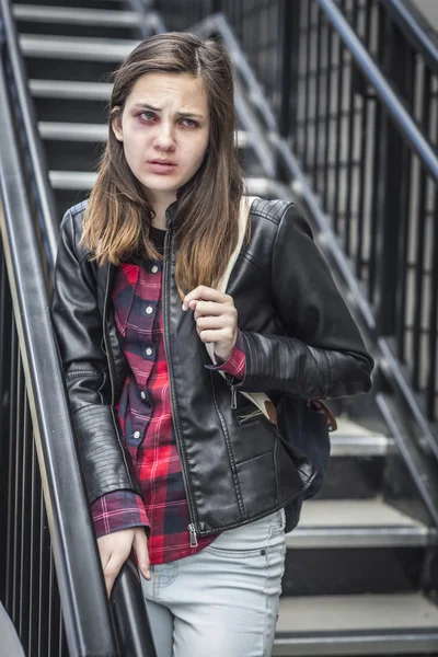 Chica joven con moretones y asustado con mochila en la escalera — Foto de Stock