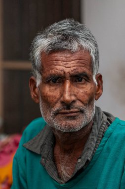 Sundarpur, Bihar Eyaleti, Hindistan, Kasım 2013 'te yerel bir cüzzam hastanesinde kimliği belirsiz Hintli hasta.